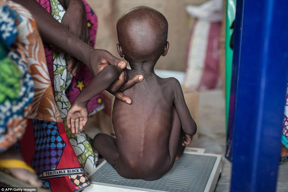75,000 children will die in Nigeria next year: UNICEF