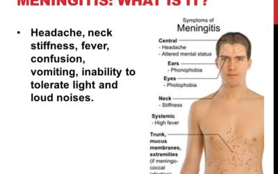 Nigeria Meningitis Epidemic: Death toll rises to 328
